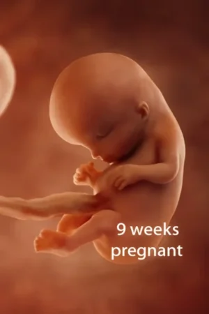 3D image of a 9-week-old fetus in the womb, showing the baby in a natural fetal position with distinct features like the head, limbs, and umbilical cord.