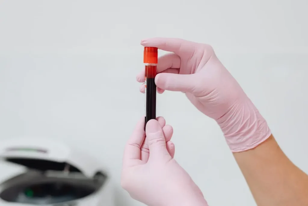 Gloved hands holding a vial of blood in a lab, illustrating First Trimester Increased Blood Volume and routine prenatal testing.