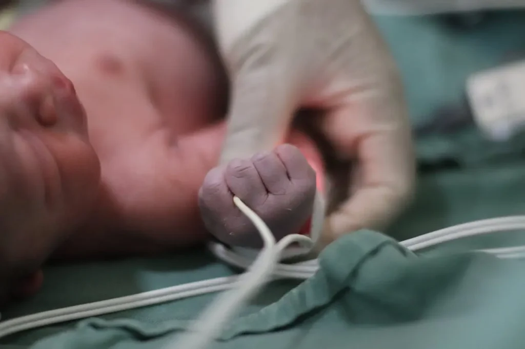Newborn’s tiny hand gripping a monitor cord while a clinician’s gloved hand provides care—moments after birth following inducing labor.